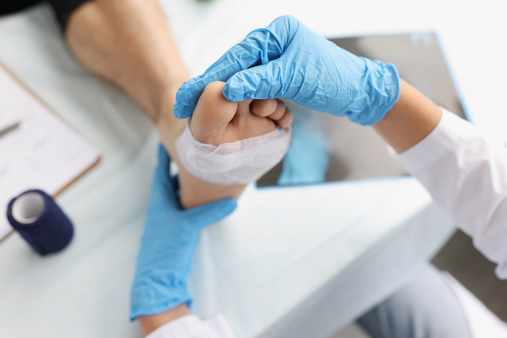 Doctor diagnoses pain and calluses on soles of feet. Pain in foot and under toes concept